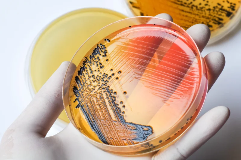 Microbiology Media Plates - Healthcare & Medical by Vcal Gmp Solutions