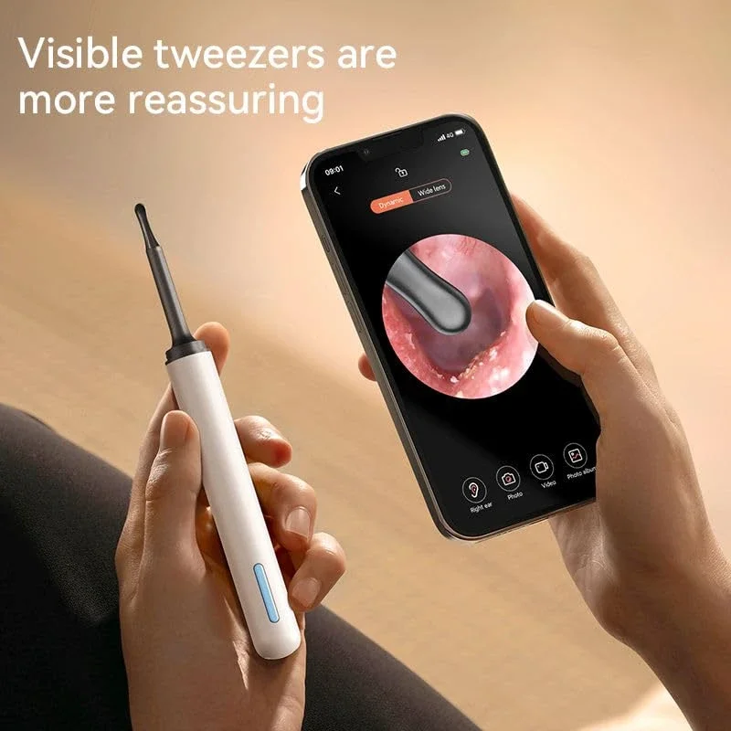 HD Camera Earwax Removal Kit with WiFi Endoscope - Healthcare & Medical by Shpinfi Online Services
