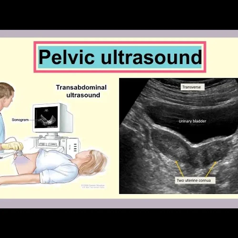 Usg Abdomen & Pelvis Male & Female - Business & Professional Services by Nithya Diagnostic Centre