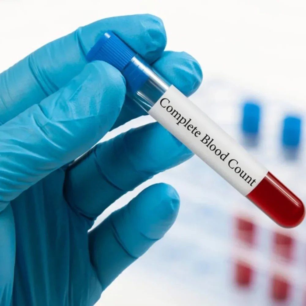 Complete Blood Count Test Service - Healthcare & Medical by Nithya Diagnostic Centre