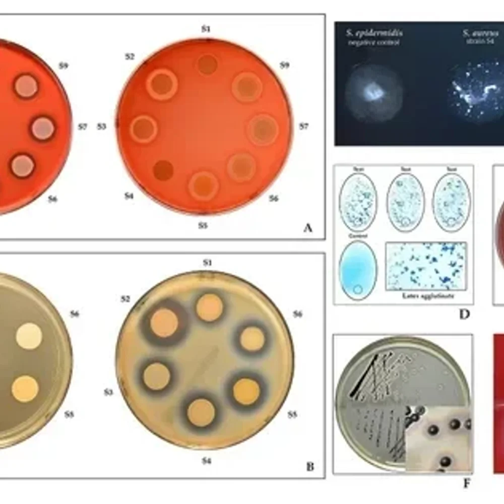 Staphylococcus Aureus Microbiological Testing Service - Business & Professional Services by Elshaddai Aradhna Group