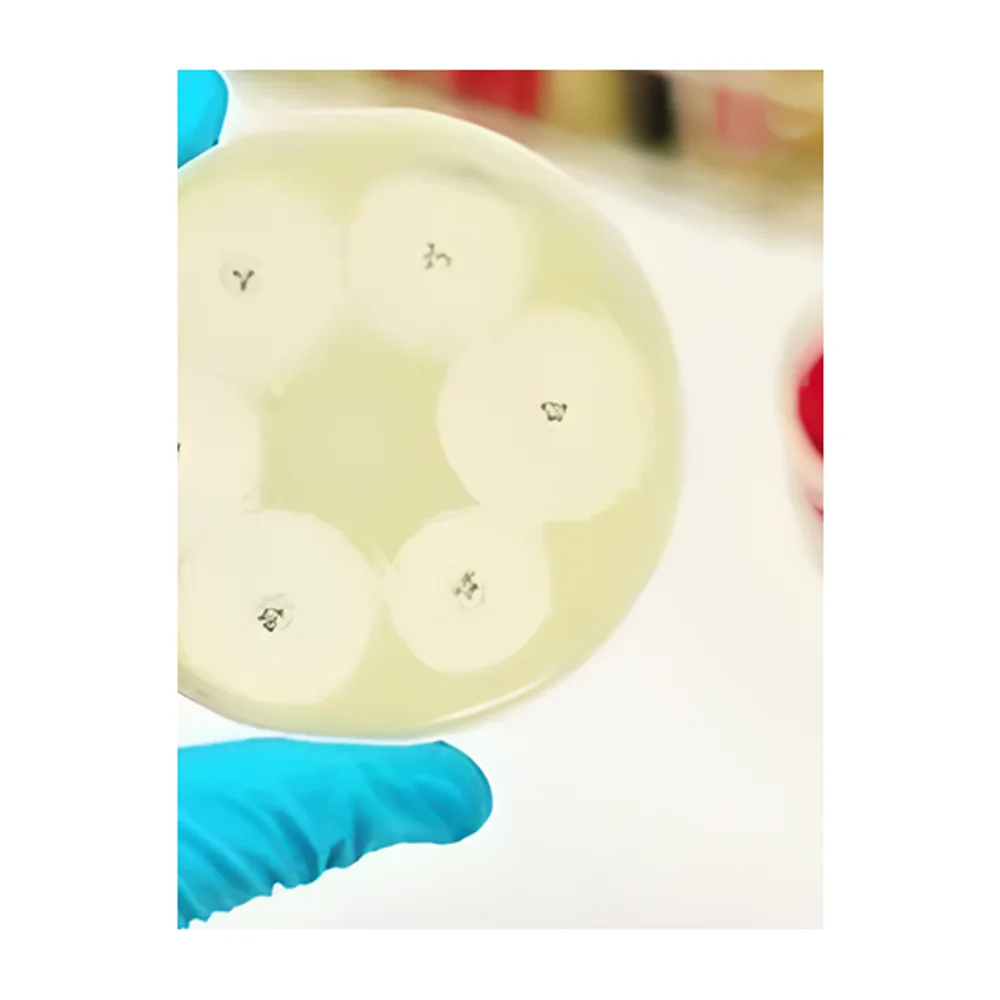 Microbial Pathogen Isolation and Sensitivity Testing Service - Business & Professional Services by Elshaddai Aradhna Group