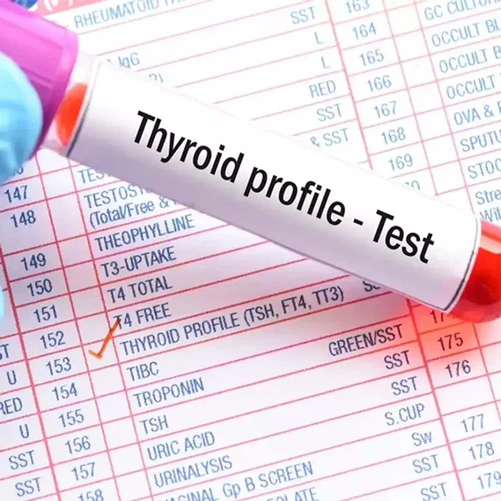 Thyroid Function Test Service - Healthcare & Medical by Nithya Diagnostic Centre