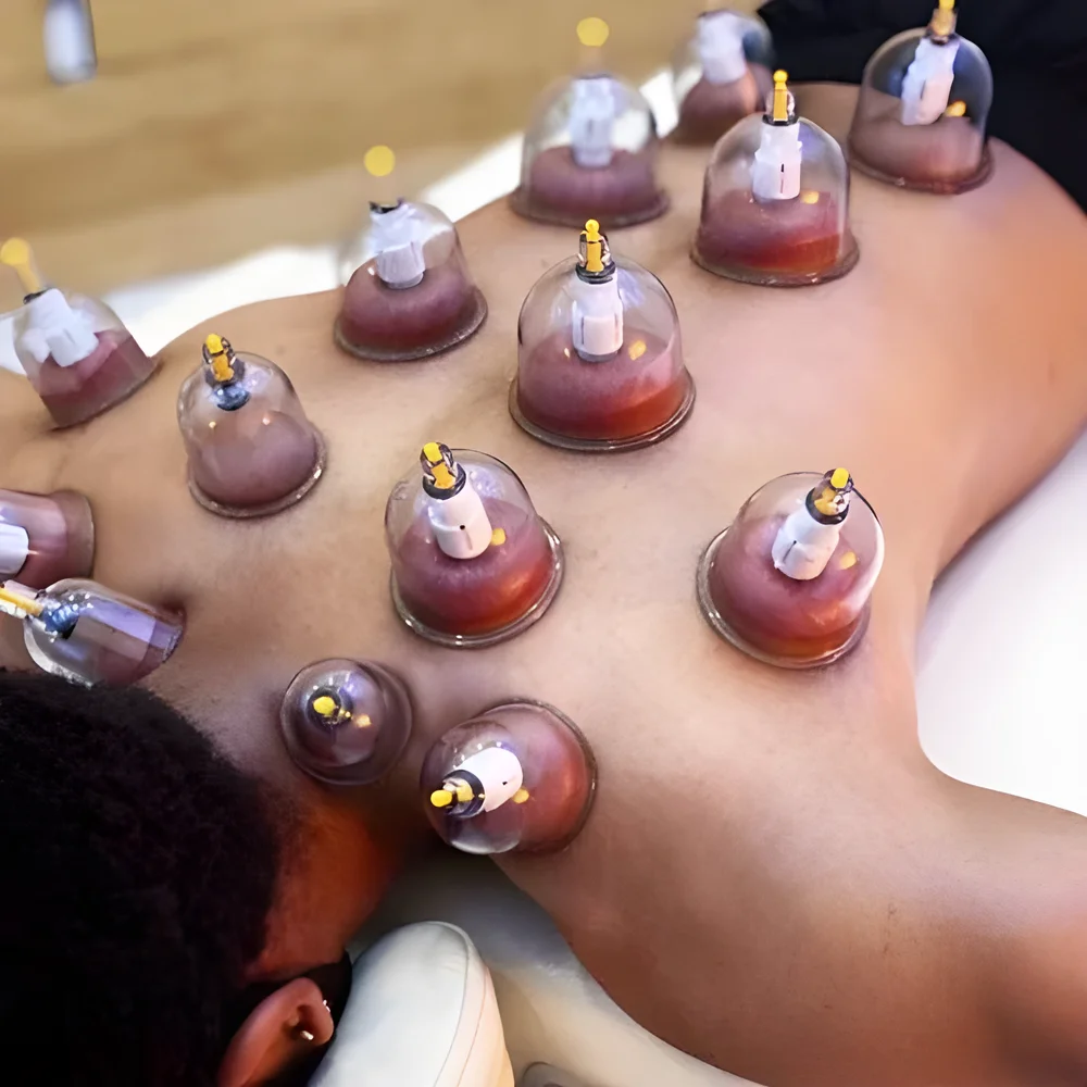 Traditional Wellness Cupping Therapy Service - Healthcare & Medical by Venu Spa Wellness Academy