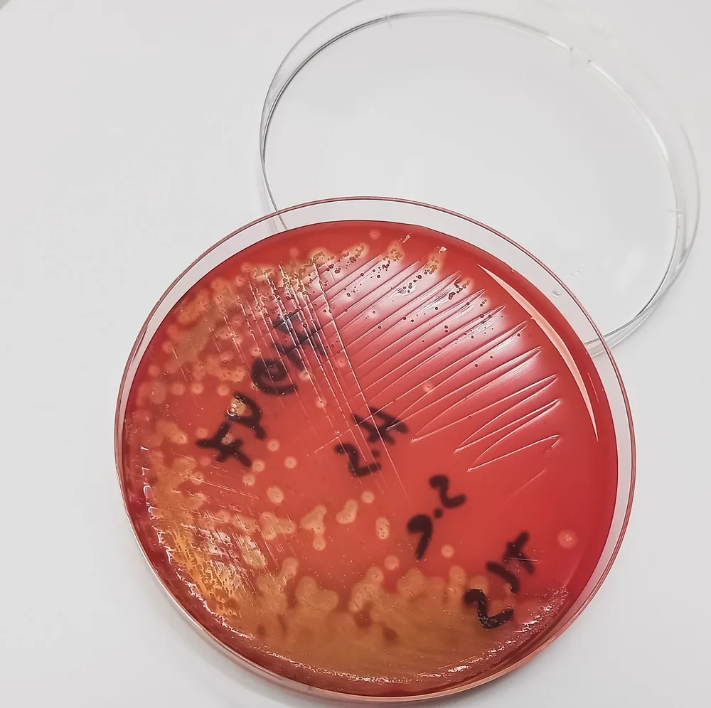 Pathogen Testing Service - Business & Professional Services by Elshaddai Aradhna Group